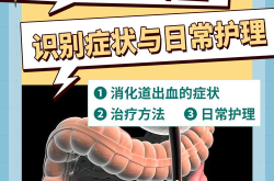 消化道出血怎么治疗,消化道出血治疗策略与方案概述